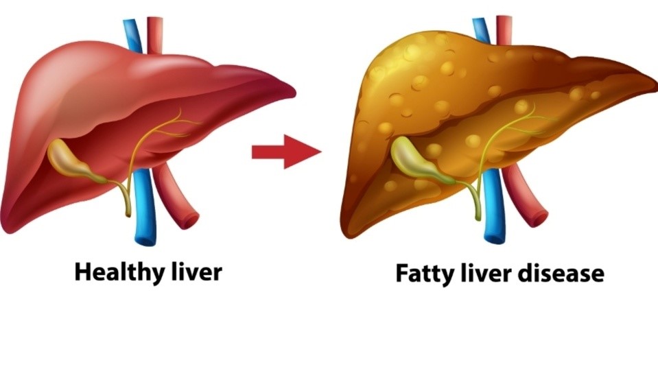 Ayurvedic Liver Health